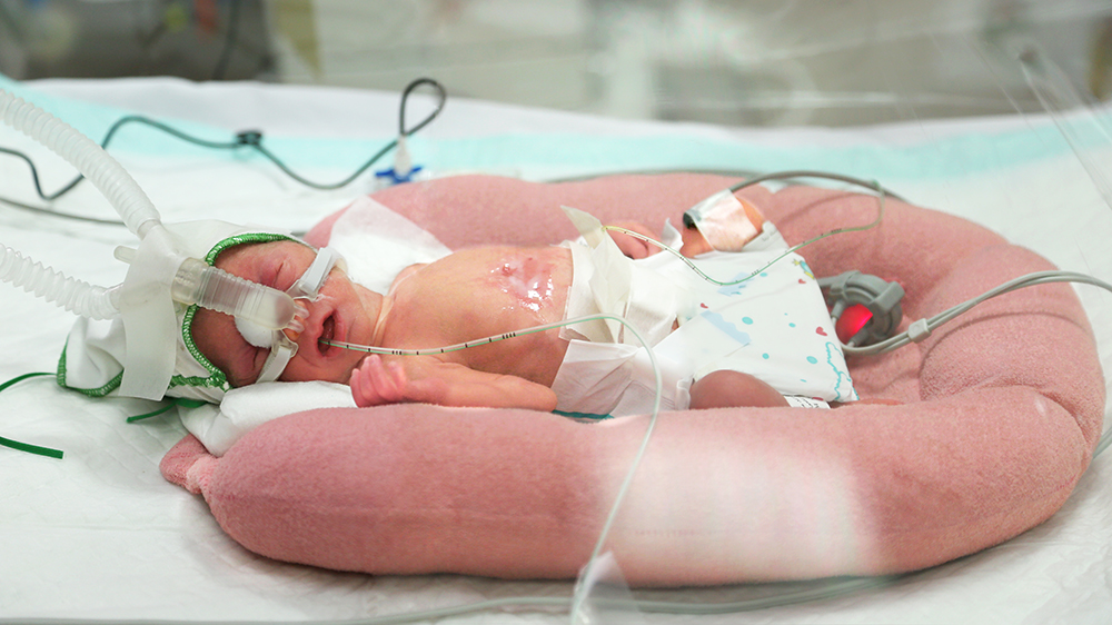 زندگی نوزادان زودرس پس از تولد در هفته‌های مختلف بارداری