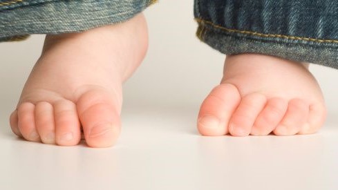 راه رفتن روی پنجه و نوک پا: آیا کودک شما هم روی پنجهٔ پا راه می‌رود؟