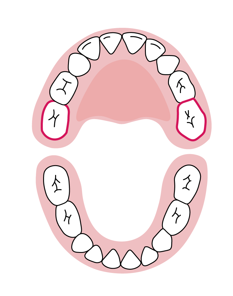 دندان‌های آسیاب دوم فک بالا: ۲۵ تا ۳۳ ماهگی